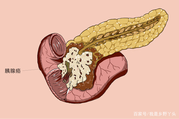 蒲公英真的能抗癌吗？