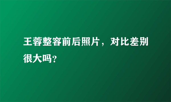 王蓉整容前后照片，对比差别很大吗？