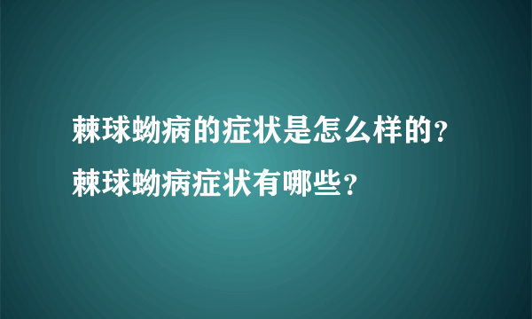 棘球蚴病的症状是怎么样的？棘球蚴病症状有哪些？