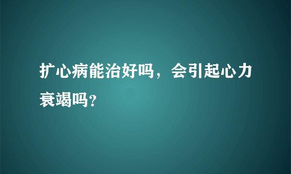 扩心病能治好吗，会引起心力衰竭吗？