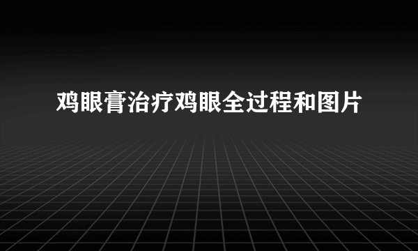 鸡眼膏治疗鸡眼全过程和图片